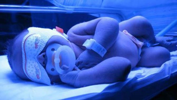 Description and action of the lamp for jaundice