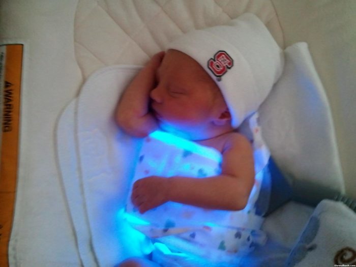 How the bulb works Description and action of the jaundice bulb