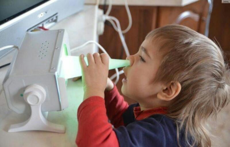 Treatment of rhinitis with Quartz Tubus.